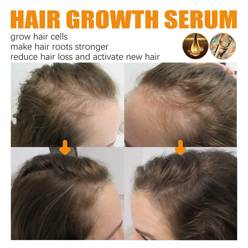 30ml Hair Growth Essence for Strong, Thick Hair Care