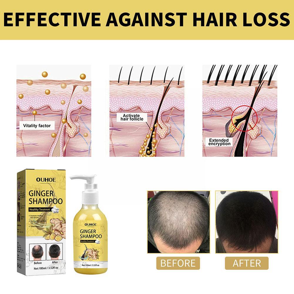 Moisturizing Anti-Itching Firming Hair Care Shampoo