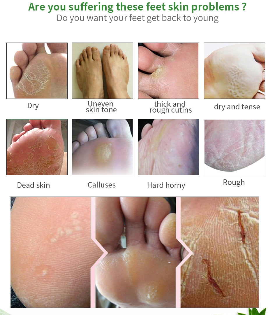 Moisturizing Foot Mask for Exfoliation and Care